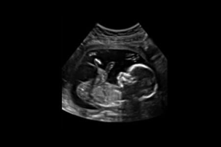 ultrasound near me brampton