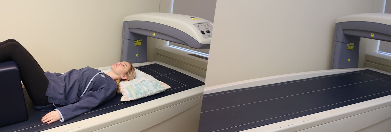 Bone Mineral Density Toronto