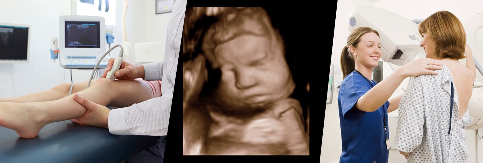 Ultrasound Clinics Toronto